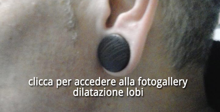 Dilatazione lobi a Torino
